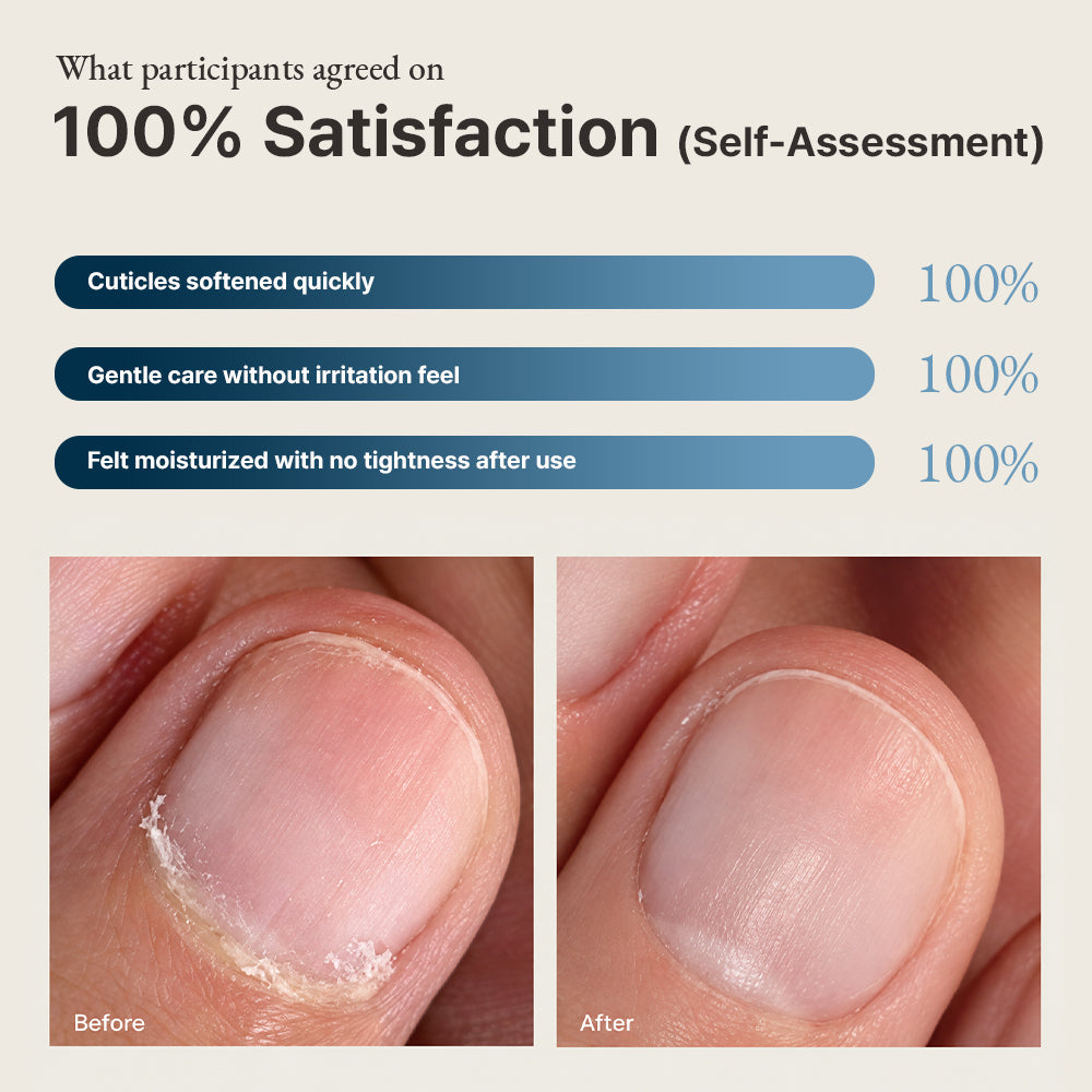 Self-assessment result of 100 percent satisfaction with before and after cuticle photos